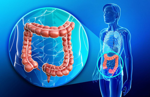 Dr. Sergio Bertolace - Procedimentos - Tumores do Intestino Grosso